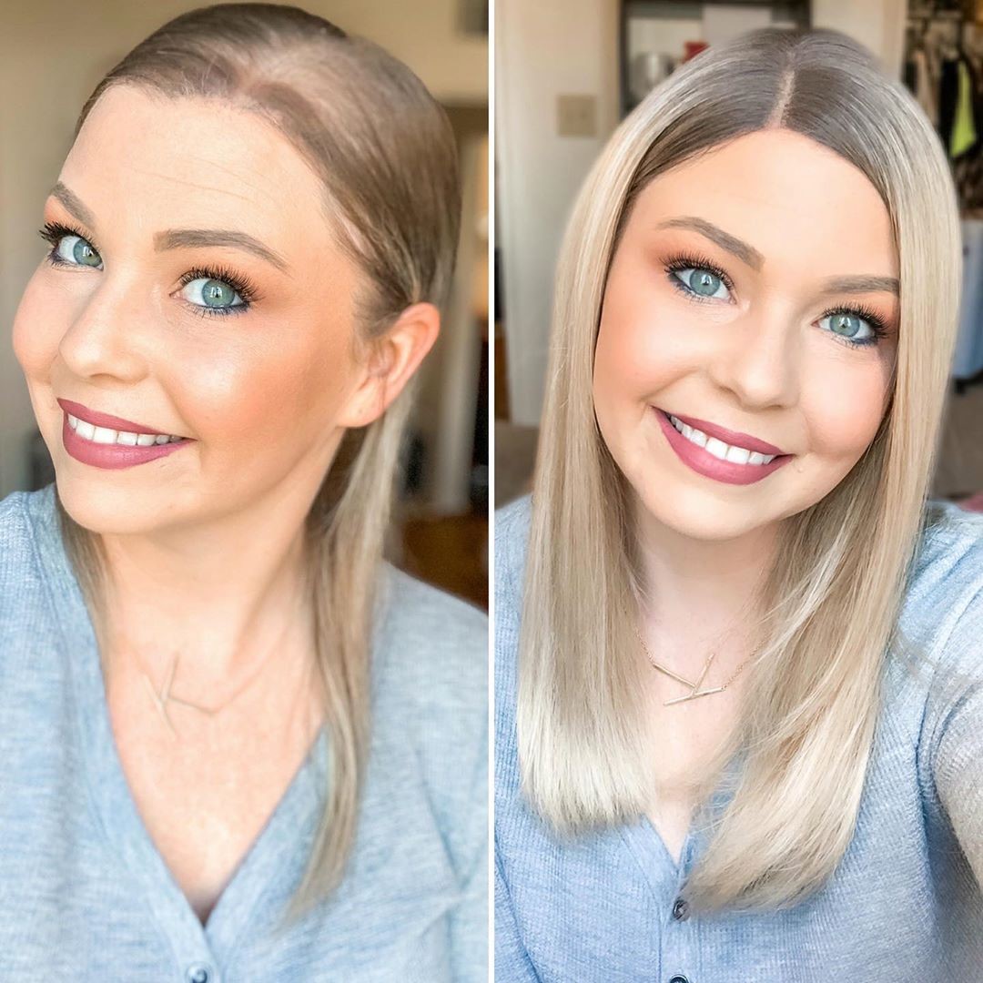 THE BEST HAIR TOPPERS WHEN YOU ARE ON A BUDGET! Hair Topper Trends THE BEST HAIR TOPPERS WHEN YOU ARE ON A BUDGET! Hair Topper Trends